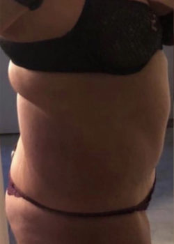 Side