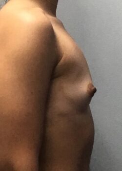 Side