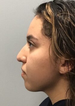 Side