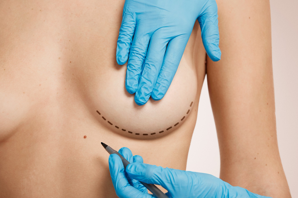 Breast Procedures